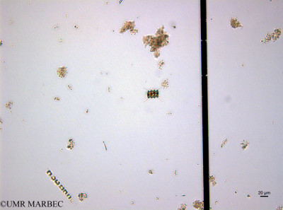 phyto/Guinea golf/Wouri_estuary_ZD-ZD1-ZD2-ZD3/YNkouefuthNfongmo_these 2022-2023/Scenedesmus sp13 (ZD2022Iden1230703_001_ovl).TIF(copy)_thumb.jpg